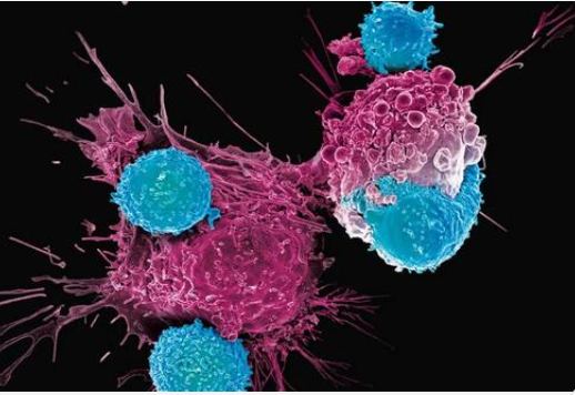 吸烟和血细胞突变可能导致影响免疫细胞的罕见癌症