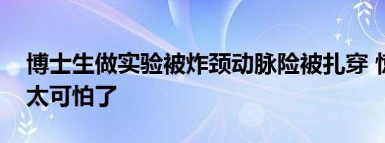 博士生做实验被炸颈动脉险被扎穿 惊险瞬间太可怕了
