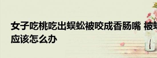 女子吃桃吃出蜈蚣被咬成香肠嘴 被蜈蚣咬了应该怎么办