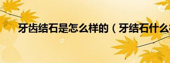 牙齿结石是怎么样的（牙结石什么样）
