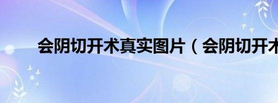 会阴切开术真实图片（会阴切开术）