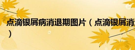 点滴银屑病消退期图片（点滴银屑消退期图片）