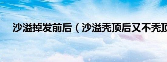 沙溢掉发前后（沙溢秃顶后又不秃顶了）