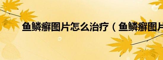 鱼鳞癣图片怎么治疗（鱼鳞癣图片）
