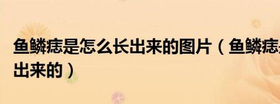 鱼鳞痣是怎么长出来的图片（鱼鳞痣是怎么长出来的）