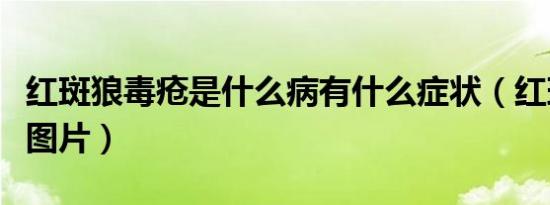 红斑狼毒疮是什么病有什么症状（红斑狼毒疮图片）