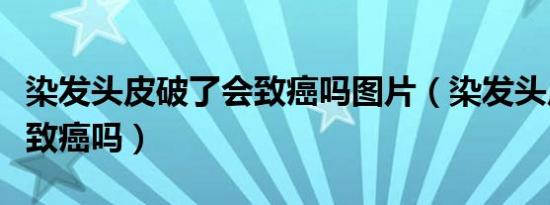 染发头皮破了会致癌吗图片（染发头皮破了会致癌吗）