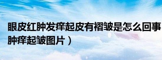 眼皮红肿发痒起皮有褶皱是怎么回事（眼皮红肿痒起皱图片）