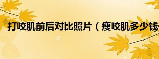 打咬肌前后对比照片（瘦咬肌多少钱一针）