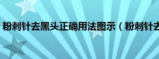 粉刺针去黑头正确用法图示（粉刺针去黑头）
