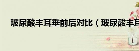 玻尿酸丰耳垂前后对比（玻尿酸丰耳垂）