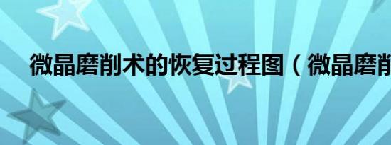 微晶磨削术的恢复过程图（微晶磨削术）