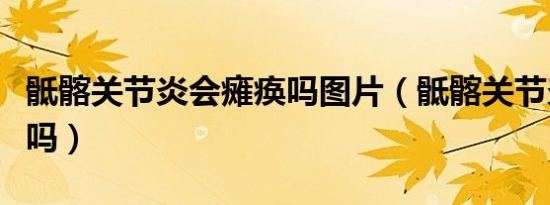骶髂关节炎会瘫痪吗图片（骶髂关节炎会瘫痪吗）