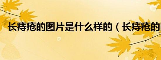 长痔疮的图片是什么样的（长痔疮的图片）
