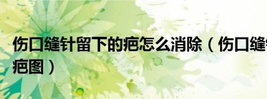 伤口缝针留下的疤怎么消除（伤口缝针后的伤疤图）